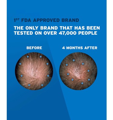 Rogaine para Hombre en Solución Tópica, 5% Minoxidil, 3 meses