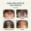 Laser Cap REVERSE HAIR LOSS • REGROW HAIR • CLINICALLY-BACKED