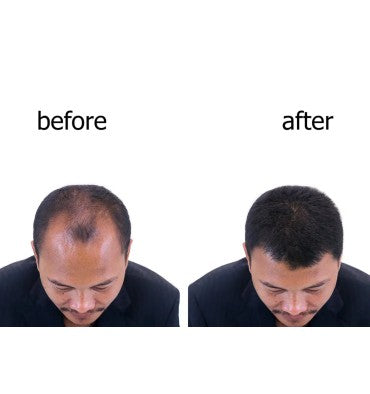 Recuperación Capilar RU58841 al 5% K&B Secado Rápido