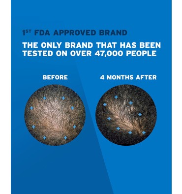 Rogaine para Hombre en Espuma, 5% Minoxidil,  caja para 3 meses