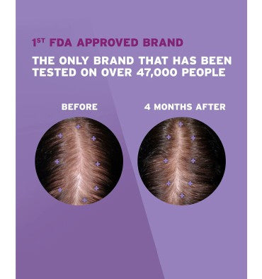 Rogaine para Mujer en Espuma, 5% Minoxidil,  caja para 4 meses