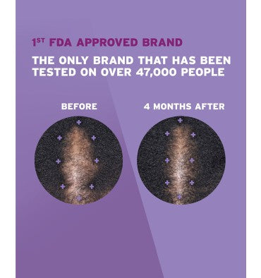 Rogaine para Mujer en Solución Tópica, 2% Minoxidil, 3 meses